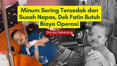 Bantu Adik Bibir Sumbing Berjuang