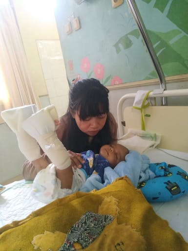 Lahir Dengan Kelamin Tidak Sempurna, Kelainan Kandung Kemih dan Organ Lainnya Berada Diluar Perut serta Fistula, Bayi Rayanza Butuh Bantuan