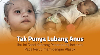 Tolong! Bantu Imam Dapatkan Operasi Lubang Anus