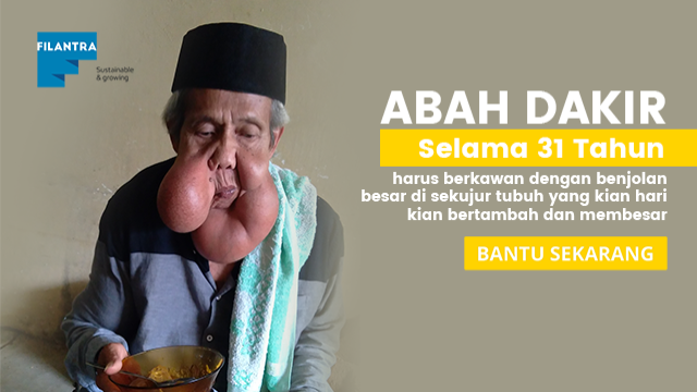31 tahun melawan tumor di sekujur tubuh