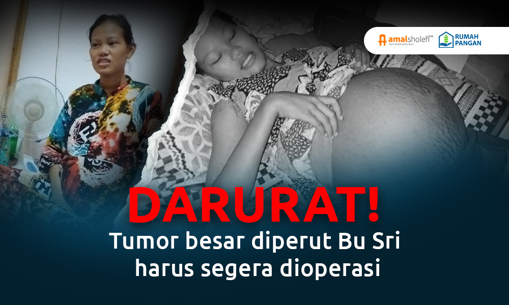Bantu Bu Sri Sembuh Dari Tumor Marker