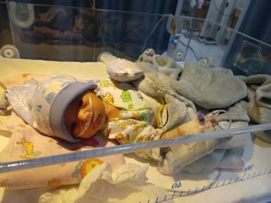 Bayi Mungil terkena 3 penyakit sekaligus !