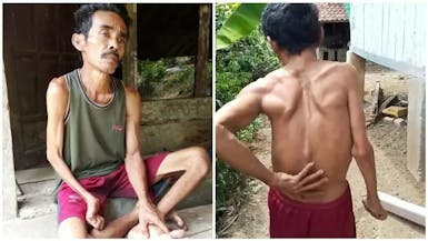 Miris! Ditinggal Istri Saat Sedang Sakit Tak Berdaya