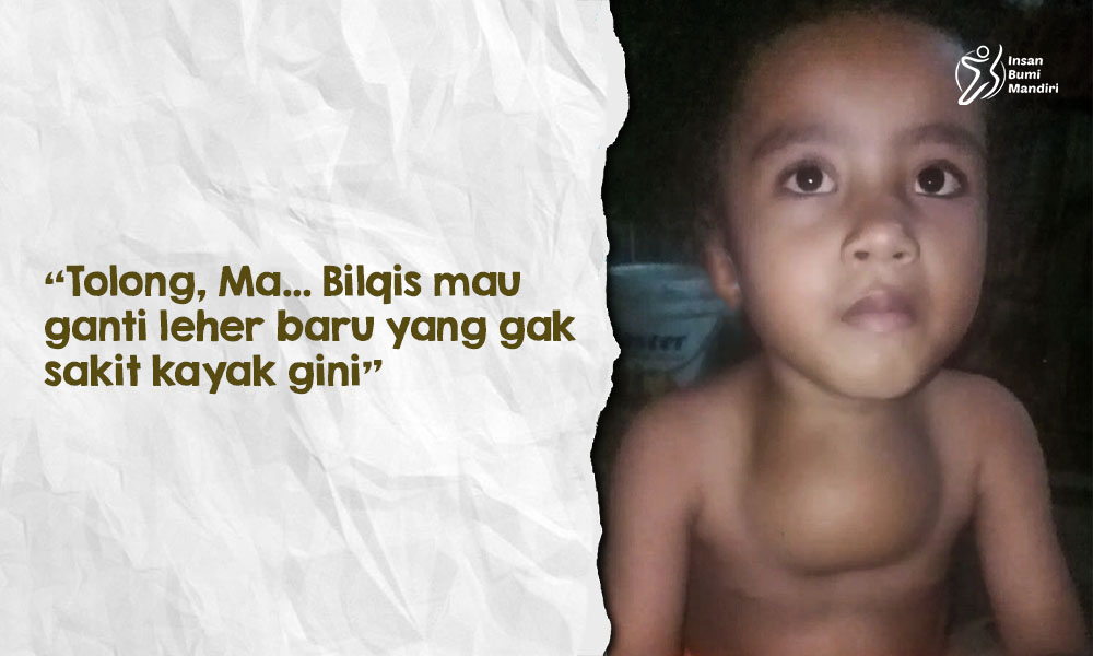 Leher Terus Membesar, Bantu Bilqis Operasi Hygroma Colli