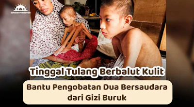 Rizal dan Muzni Alami Gizi Buruk