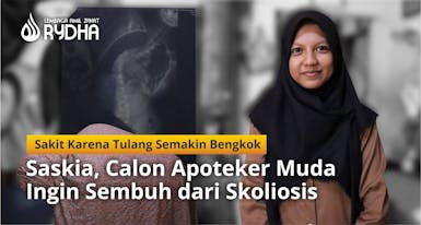 Bantu Saskia, Calon Apoteker Muda Sembuh dari Tulang Bengkok