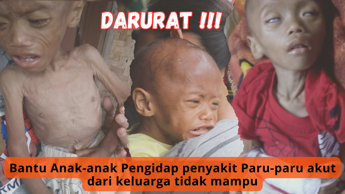 Darurat : Bantu Anak - anak terkena penyakit Paru Akut Dari Keluarga Kurang Mampu