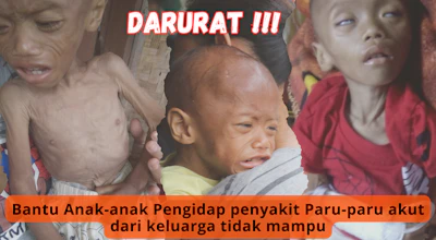 Darurat : Bantu Anak - anak terkena penyakit Paru Akut Dari Keluarga Kurang Mampu