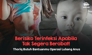 BAB Lewat Usus yang Keluar dari Perutnya, Bantu Thoriq Bisa BAB Normal