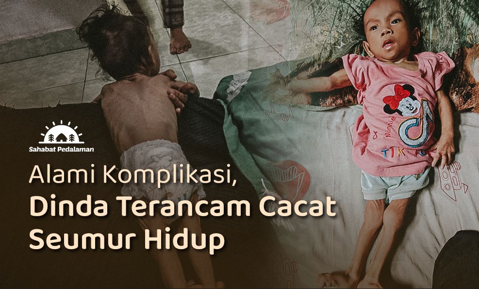 Badan Tinggal Tulang, Bantu Dinda Sembuh dari Gizi Buruk