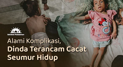 Badan Tinggal Tulang, Bantu Dinda Sembuh dari Gizi Buruk