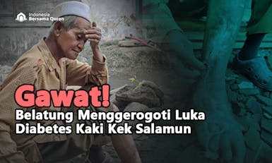 Luka Diabetes Semakin Parah, Bantu Kek Salamun Berobat Segera
