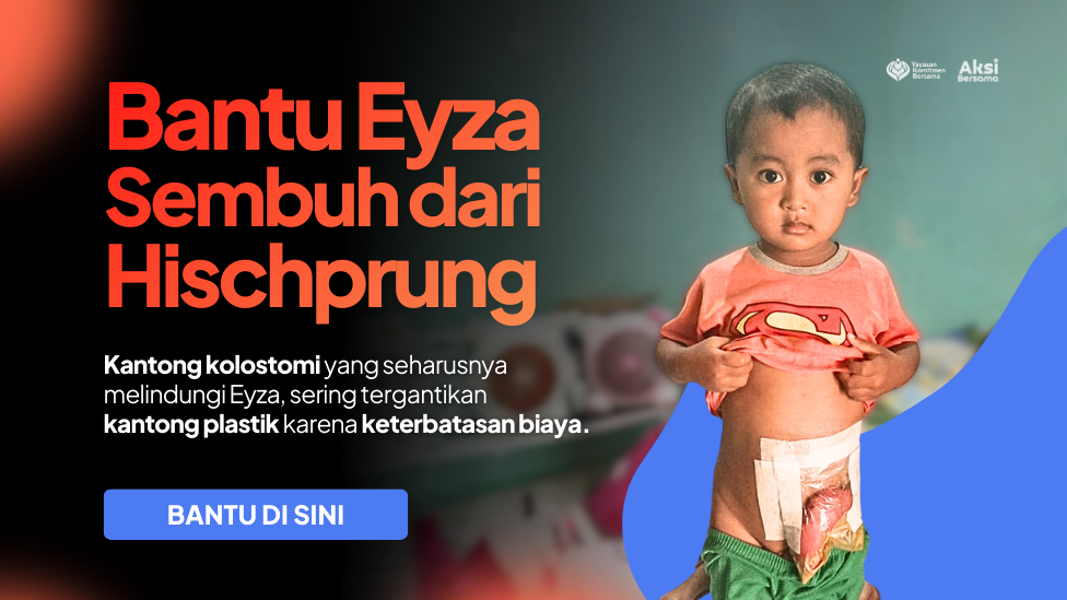 Bantu Eyza Sembuh dari Hischprung