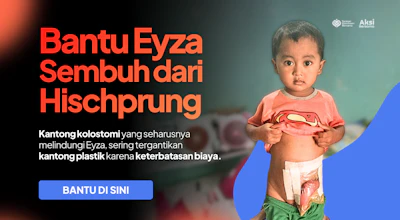 Bantu Eyza Sembuh dari Hischprung