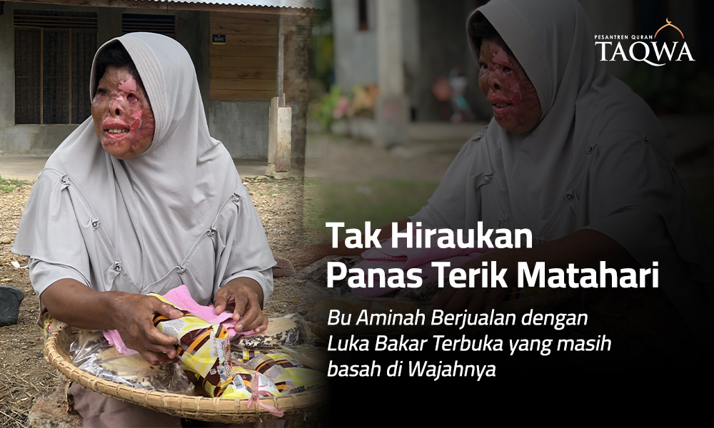 Bantu Bu Aminah Sembuh dari Luka Bakar
