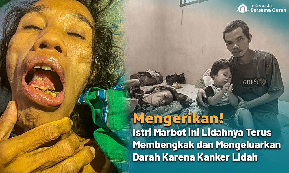 Selamatkan Nyawa Bu Nirmala dari Kanker Lidah