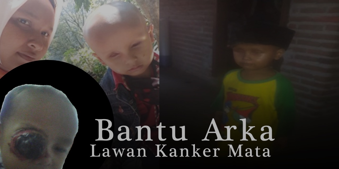 Bantu Arka Lawan Kanker Mata