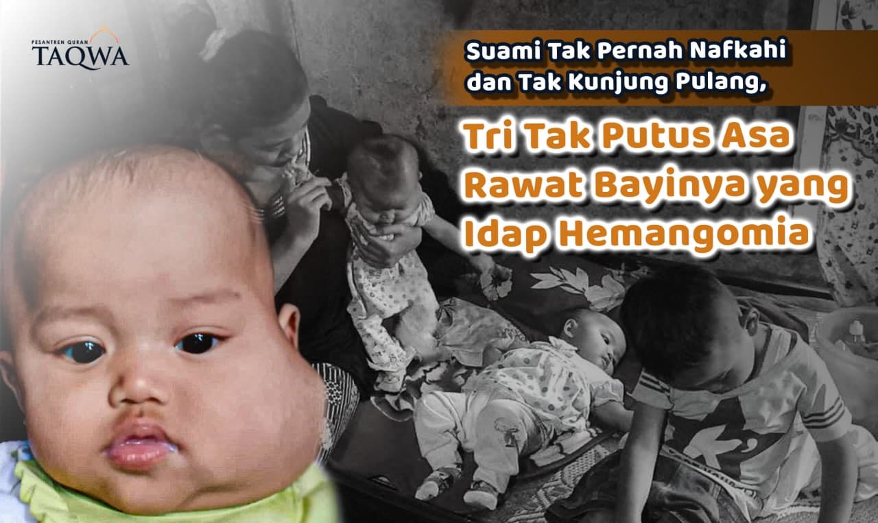 Bantu Mbak Tri Obati Hemangioma Aliesha