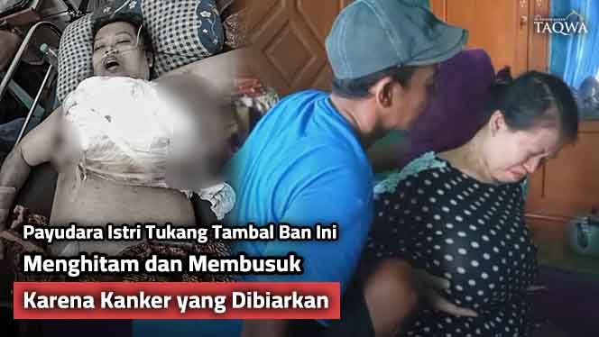 Selamatkan Nyawa Bu Lilis dari Kanker Payudara Ganas