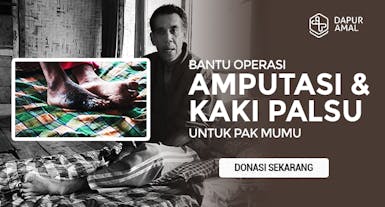 Bantu Amputasi Kaki dan Kaki Palsu untuk Pak Mumu