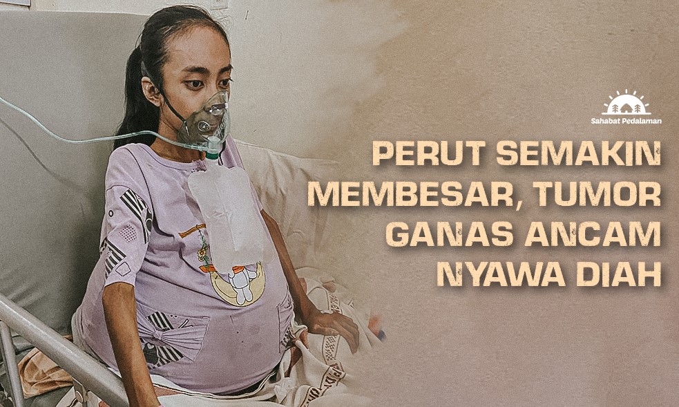 Tumor Ganas di Perut Ancam Nyawa Diah