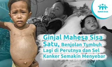 Kritis! Hidup Mahesa Divonis Satu Bulan Lagi
