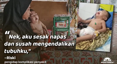 Ditemani Sang Nenek, Riski Berjuang Lawan 4 Penyakit Kronis