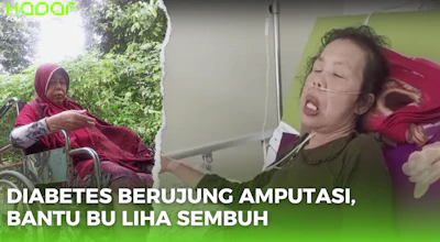 Diabetes Berujung Amputasi, Bu Liha Masih Berjuang Sembuh