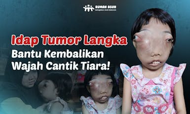 URGENT!! Tumor Langka Mengancam Keselamatan Tiara