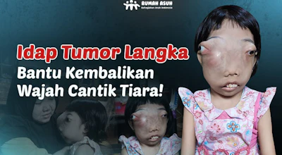 URGENT!! Tumor Langka Mengancam Keselamatan Tiara