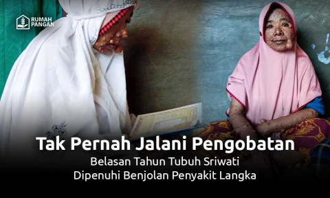 Belasan Tahun Terkena Penyakit Kulit Langka, Seluruh Tubuh Sriwati Dipenuhi Benjolan