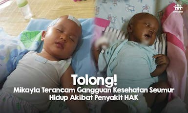 Kulit Menghitam! Mikayla Alami Penyakit Langka Hiperplasia Adrenal Kongenital