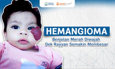 Harus Diangkat! Hemangioma Rayyan Makin Membesar