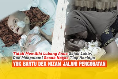 Menderita Atresia Ani dan Sesak Nafas, Nizam Membutuhkan Perawatan Intensif