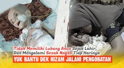 Menderita Atresia Ani dan Sesak Nafas, Nizam Membutuhkan Perawatan Intensif