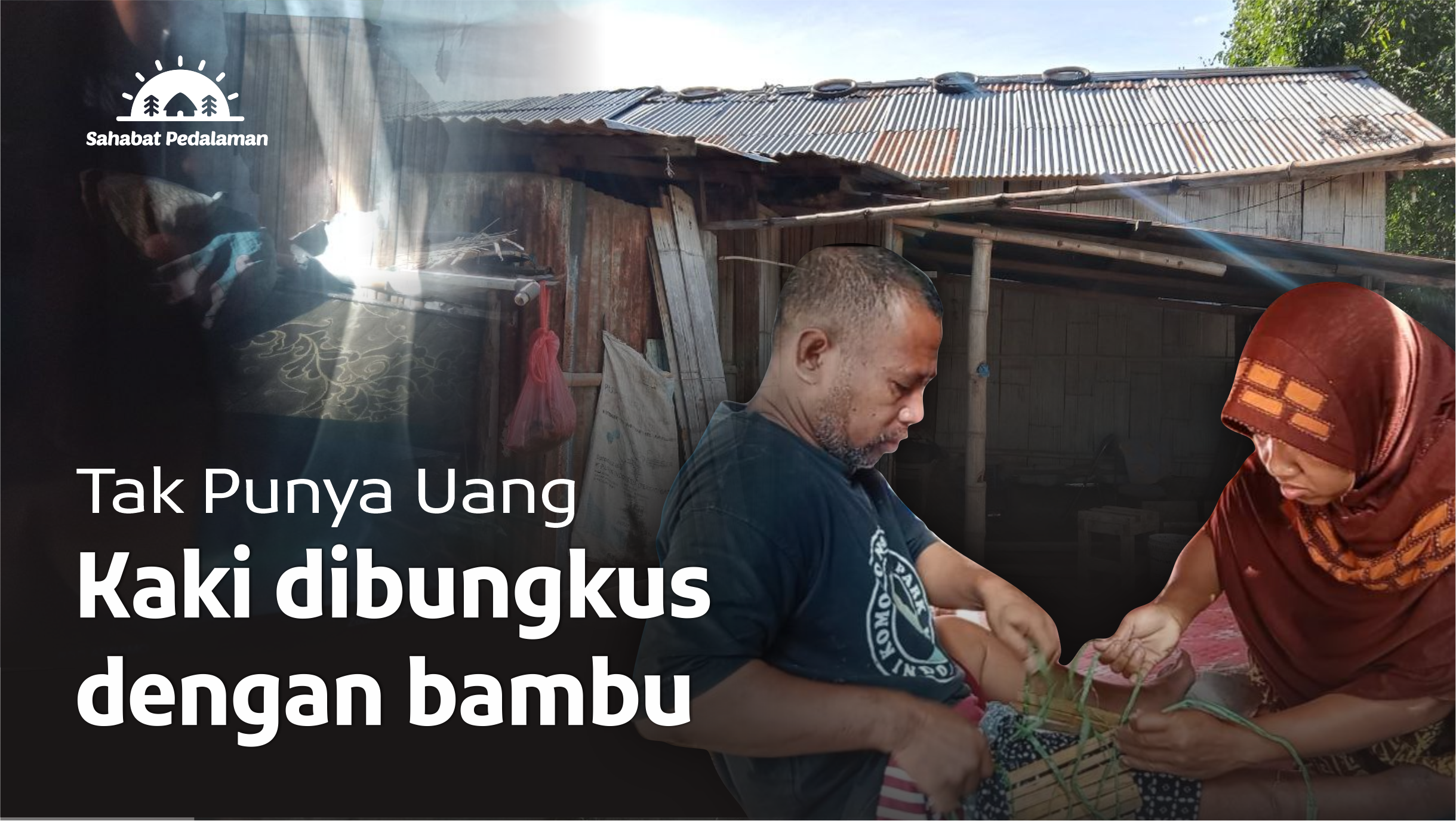 Patah Tulang, Pak Amran Tak Bisa Nafkahi Keluarga