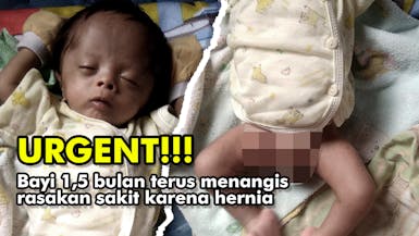 Urgent!!! Baha'udin Bayi 1,5 Bulan Harus Segera Operasi Karena Hernia