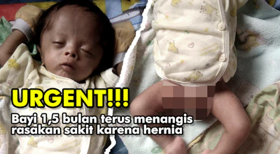 Urgent!!! Baha'udin Bayi 1,5 Bulan Harus Segera Operasi Karena Hernia