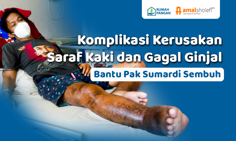 Alami Gagal Ginjal dan Kelainan Saraf di Kaki, Tubuh Pak Sumardi Membengkak