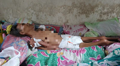 URGENT!!!! anemia akut bu muliy memasuki fase serius