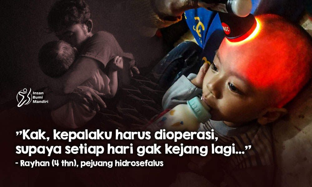 Temani Rayhan Berjuang Lawan Hidrosefalus
