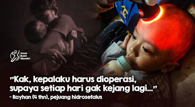 Temani Rayhan Berjuang Lawan Hidrosefalus