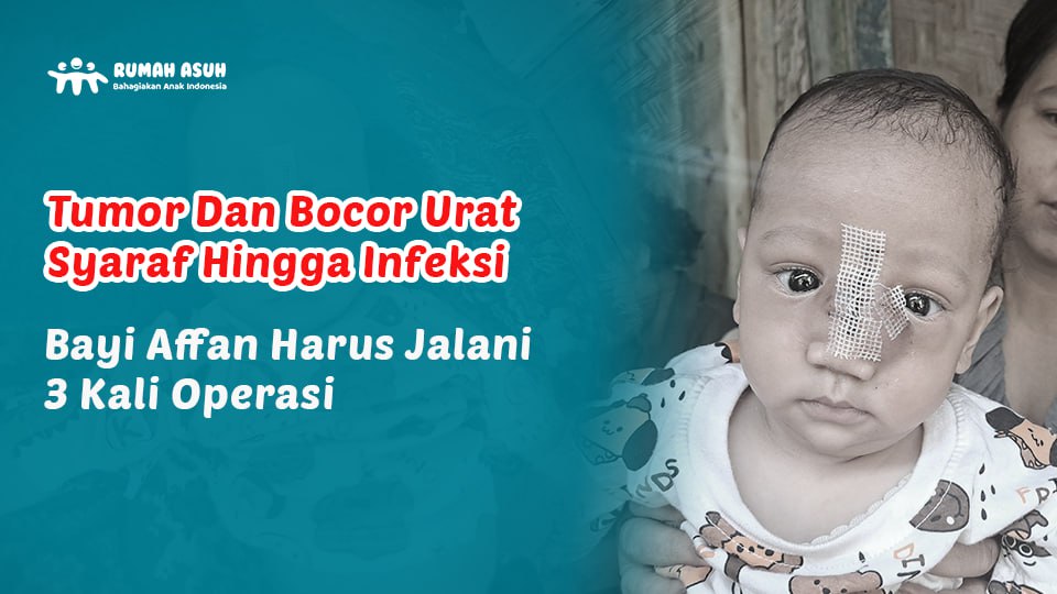 Temani Perjuangan Affan Melawan Tumor dan Bocor Urat Syaraf
