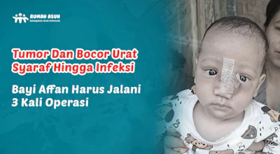 Temani Perjuangan Affan Melawan Tumor dan Bocor Urat Syaraf