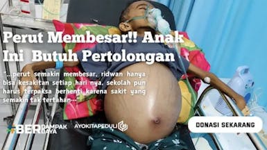 Perut Semakin Besar!! Ridwan Semakin Kesakitaan