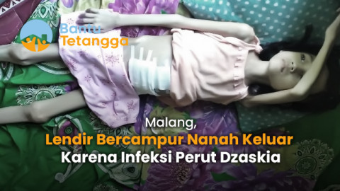 Sakit Usus Lengketnya Kian Parah, Dzaskia Ingin Sembuh