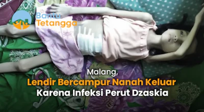 Sakit Usus Lengketnya Kian Parah, Dzaskia Ingin Sembuh