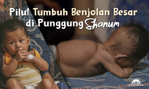 Alami Meningokel Di Punggung, Shanum Beresiko Lumpuh