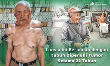 Bantu kek Engkok Sembuh dari Tumor
