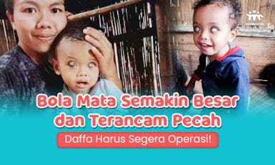 Terancam Buta Total! Tolong Daffa dari Tumor Mata